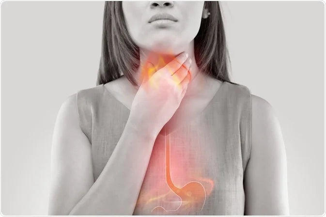 What Supplements Can Help You With Acid Reflux & Heartburn
