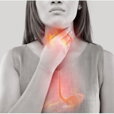 What Supplements Can Help You With Acid Reflux & Heartburn